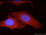 SEPT9 Antibody in Immunocytochemistry (ICC/IF)