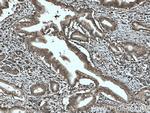 SEPT9 Antibody in Immunohistochemistry (Paraffin) (IHC (P))