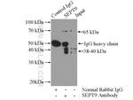 SEPT9 Antibody in Immunoprecipitation (IP)