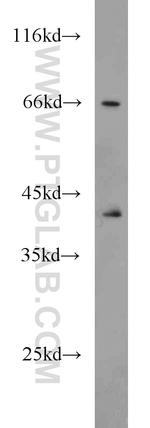 SEPT9 Antibody in Western Blot (WB)