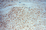 MSI2 Antibody in Immunohistochemistry (Paraffin) (IHC (P))