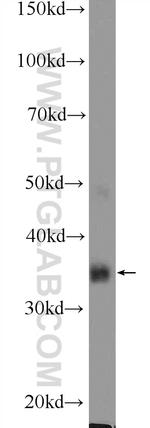 MSI2 Antibody in Western Blot (WB)