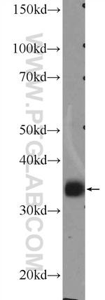 MSI2 Antibody in Western Blot (WB)