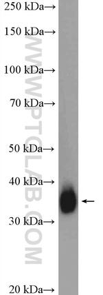 MSI2 Antibody in Western Blot (WB)