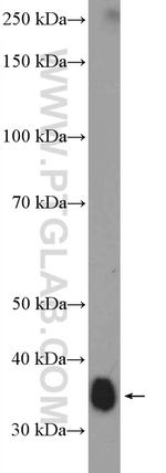 MSI2 Antibody in Western Blot (WB)