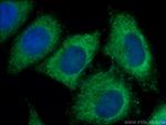 PACT Antibody in Immunocytochemistry (ICC/IF)