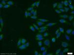 SNX3 Antibody in Immunocytochemistry (ICC/IF)