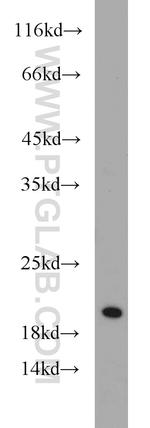 SNX3 Antibody in Western Blot (WB)