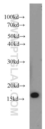 SNX3 Antibody in Western Blot (WB)