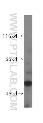 PRIM1 Antibody in Western Blot (WB)