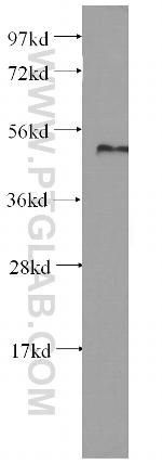 PRIM1 Antibody in Western Blot (WB)