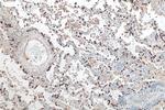 SFTPC Antibody in Immunohistochemistry (Paraffin) (IHC (P))