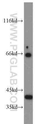 BLVRA Antibody in Western Blot (WB)