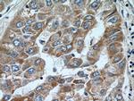 Dopamine beta Hydroxylase Antibody in Immunohistochemistry (Paraffin) (IHC (P))