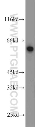 Dopamine beta Hydroxylase Antibody in Western Blot (WB)