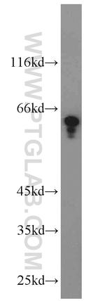 Dopamine beta Hydroxylase Antibody in Western Blot (WB)