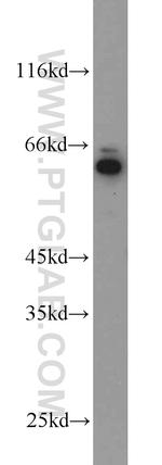 Dopamine beta Hydroxylase Antibody in Western Blot (WB)