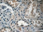 Adrenomedullin Antibody in Immunohistochemistry (Paraffin) (IHC (P))