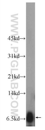 Adrenomedullin Antibody in Western Blot (WB)