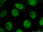 TDP-43 Antibody in Immunocytochemistry (ICC/IF)