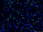 TDP-43 Antibody in Immunohistochemistry (PFA fixed) (IHC (PFA))