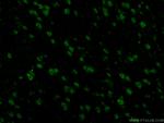 TDP-43 Antibody in Immunohistochemistry (PFA fixed) (IHC (PFA))