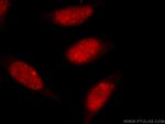 TDP-43 Antibody in Immunocytochemistry (ICC/IF)