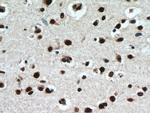 TDP-43 Antibody in Immunohistochemistry (Paraffin) (IHC (P))