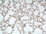 TDP-43 Antibody in Immunohistochemistry (Paraffin) (IHC (P))