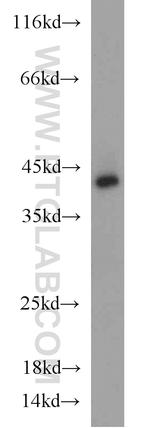 TDP-43 Antibody in Western Blot (WB)