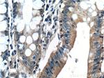 Bcl-XL Antibody in Immunohistochemistry (Paraffin) (IHC (P))