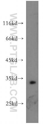Bcl-XL Antibody in Western Blot (WB)