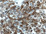 Bcl-XL Antibody in Immunohistochemistry (Paraffin) (IHC (P))