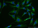 LDLR Antibody in Immunocytochemistry (ICC/IF)