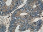 LDLR Antibody in Immunohistochemistry (Paraffin) (IHC (P))