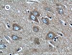 LDLR Antibody in Immunohistochemistry (Paraffin) (IHC (P))