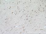 LDLR Antibody in Immunohistochemistry (Paraffin) (IHC (P))