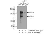 LDLR Antibody in Immunoprecipitation (IP)