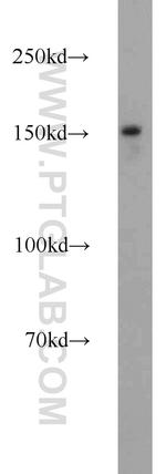 LDLR Antibody in Western Blot (WB)