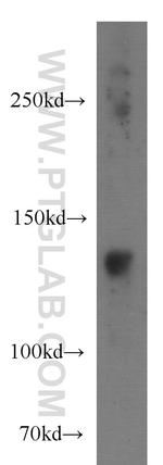 LDLR Antibody in Western Blot (WB)