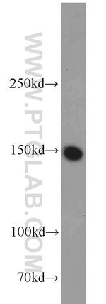 LDLR Antibody in Western Blot (WB)