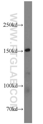 LDLR Antibody in Western Blot (WB)