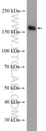 LDLR Antibody in Western Blot (WB)