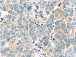 TRIM9 Antibody in Immunohistochemistry (Paraffin) (IHC (P))