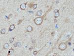 TRIM9 Antibody in Immunohistochemistry (Paraffin) (IHC (P))