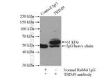 TRIM9 Antibody in Immunoprecipitation (IP)