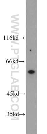 TRIM9 Antibody in Western Blot (WB)