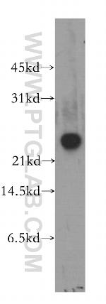 RAB3C Antibody in Western Blot (WB)