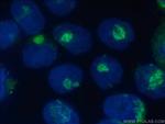 ARF1 Antibody in Immunocytochemistry (ICC/IF)