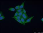 ARF1 Antibody in Immunocytochemistry (ICC/IF)